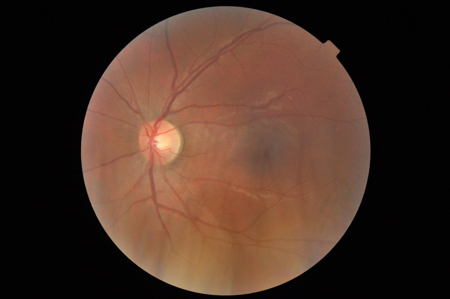 Take good care of your eyes, you can only screw it up twice.